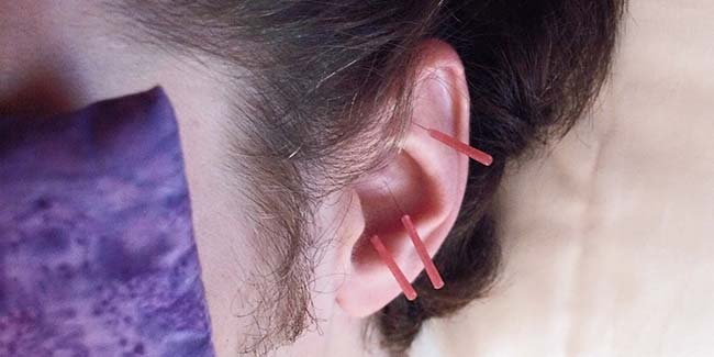 Suffering from chronic pain and depression? Try acupuncture